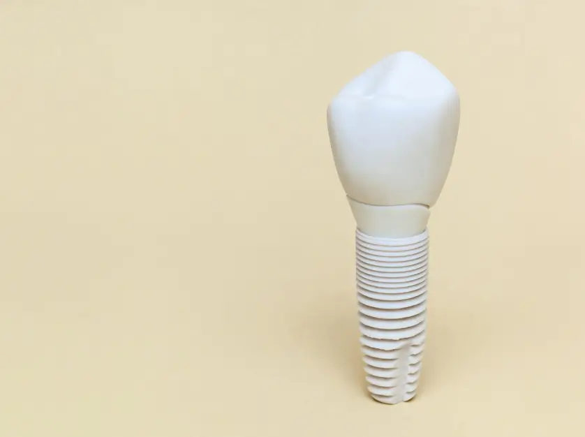 Single-Tooth Dental Implants