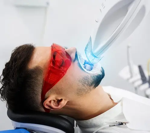 zoom-whitening-image